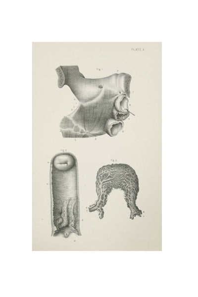 Medical Anatomical Prints  - 1880's Original Prints