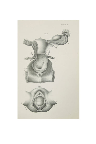 Medical Anatomical Prints  - 1880's Original Prints
