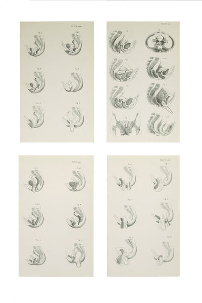Medical Anatomical Prints of Female Pelvic Organs - 1880's Medical Drawings