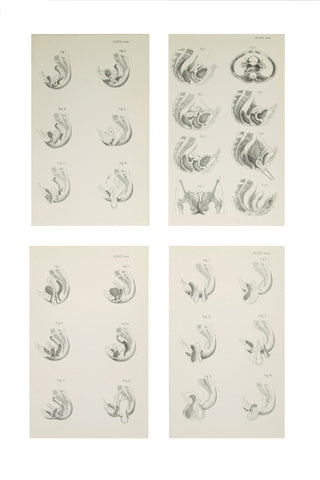 Medical Anatomical Prints of Female Pelvic Organs - 1880's Medical Drawings