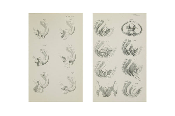 Medical Anatomical Prints of Female Pelvic Organs - 1880's Medical Drawings