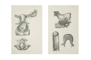 Medical Anatomical Prints  - 1880's Original Prints