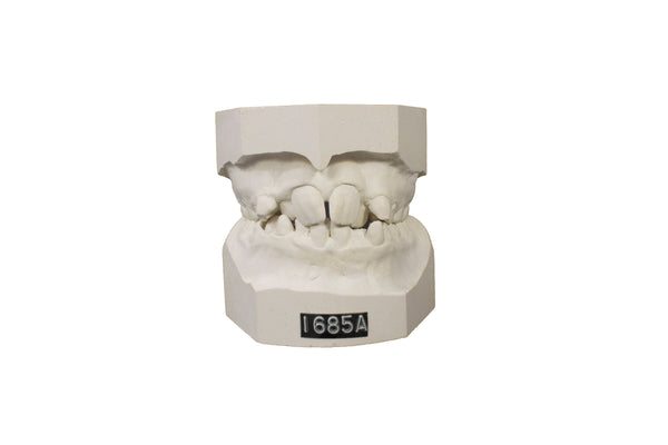 Make an Impression!  Dental Molds Set of 3
