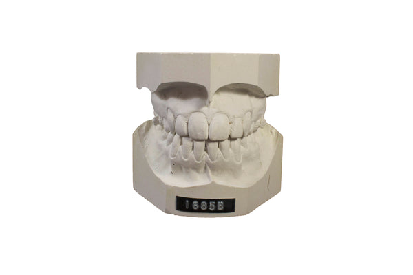 Make an Impression!  Dental Molds Set of 3
