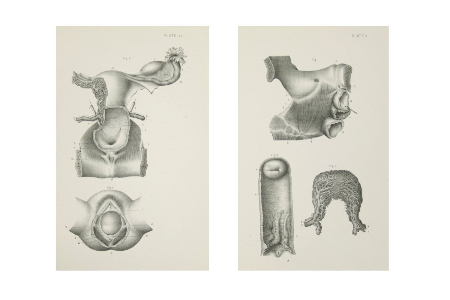 Medical Anatomical Prints  - 1880's Original Prints